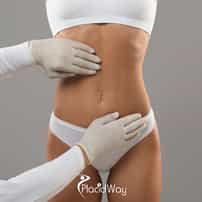 7 Reasons UK Patients Are Choosing Gastric Sleeve Surgery in Turkey Over NHS Waitlists